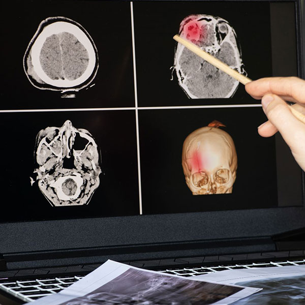Xray image of facial trauma