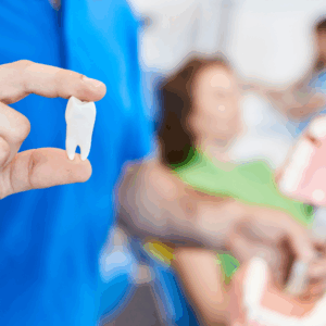 Tooth Extraction Procedure
