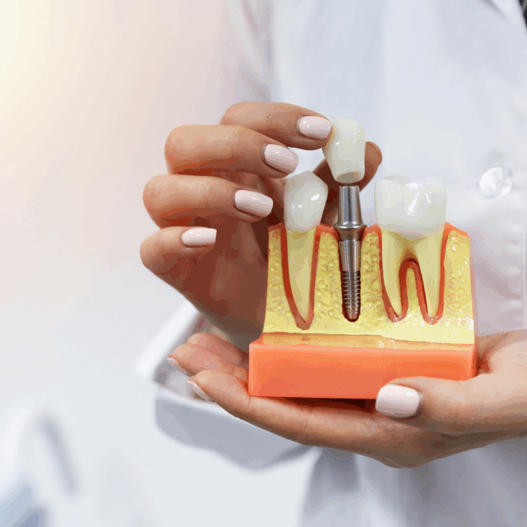 Tooth Replacement